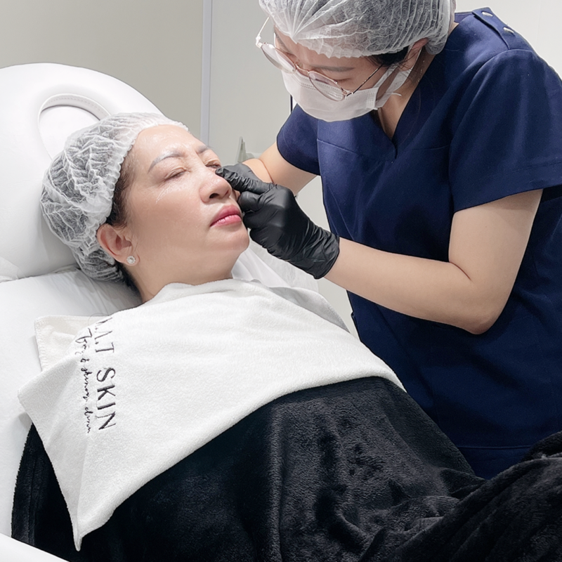 Chemical Peel